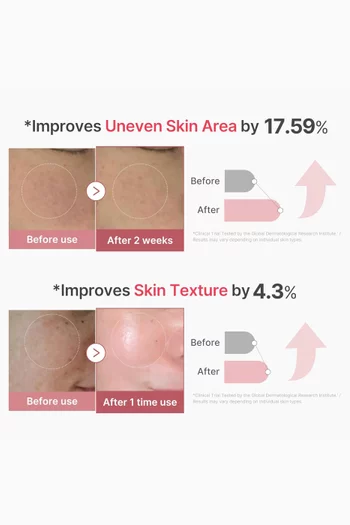 سيروم الإكسوسومات الوردي بالكولاجين ومركب بوليديوكسيريبونكليوتيد 2000 جزء في المليون، سيروم سائل معزز للبشرة